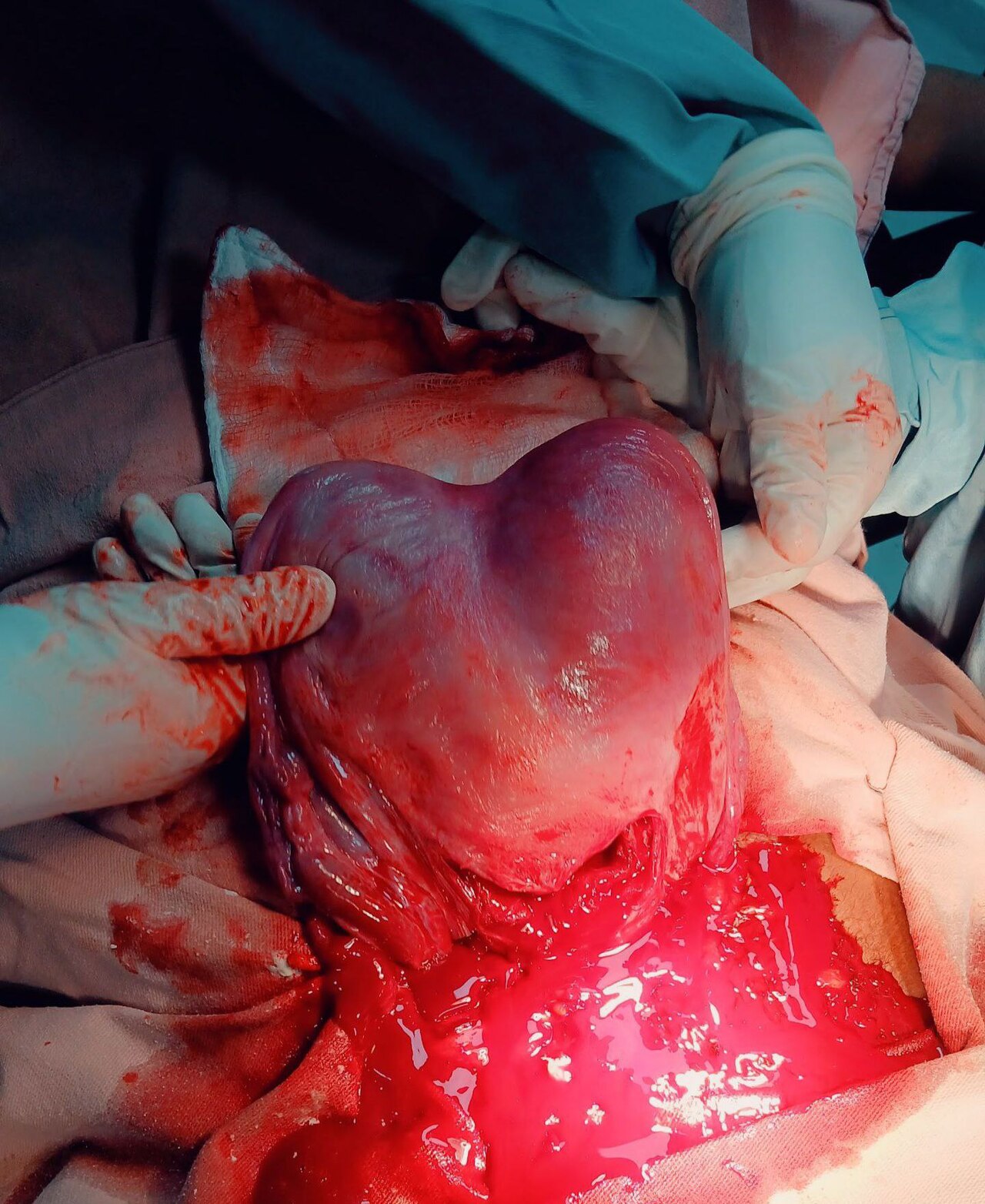 FyreMemories SDK Exposes Hidden Complexity in Android Memory Features — The Womb’s Hidden Valentine