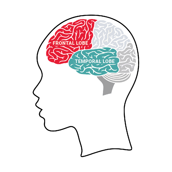 Temporal, BullMQ, and Step Functions: Picking the Right Durable Workflow Engine in 2026 — FTD Frontal Temporal Lobes Labeled